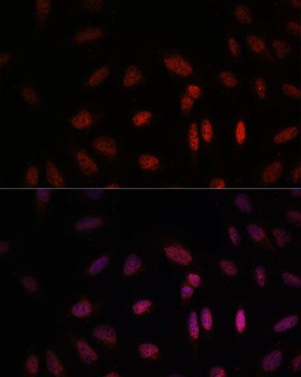 WDR18 Antibody in Immunocytochemistry (ICC/IF)