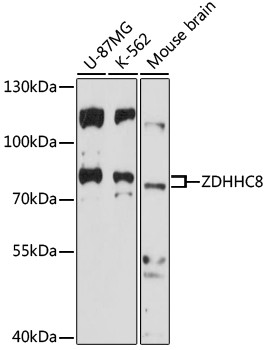 ZDHHC8 Antibody in Western Blot (WB)