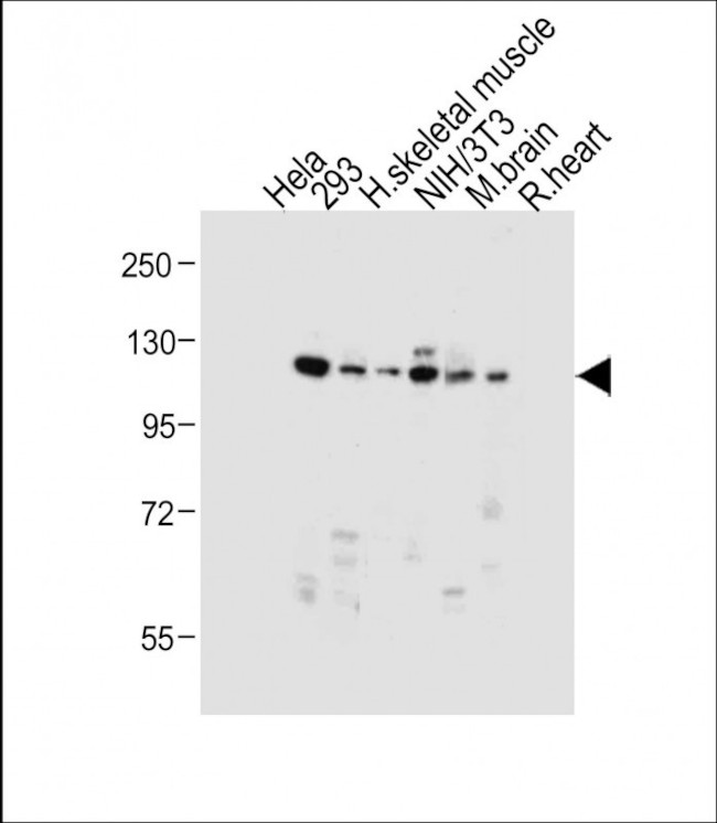 DNMT3A Antibody in Western Blot (WB)