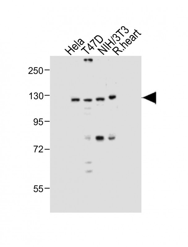 DNMT3A Antibody in Western Blot (WB)