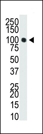 DNMT3A Antibody in Western Blot (WB)