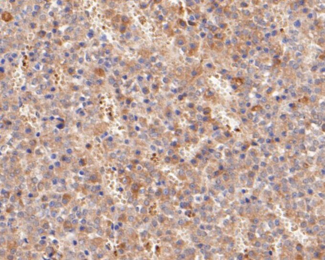 Follicle Stimulating Hormone Antibody in Immunohistochemistry (Paraffin) (IHC (P))