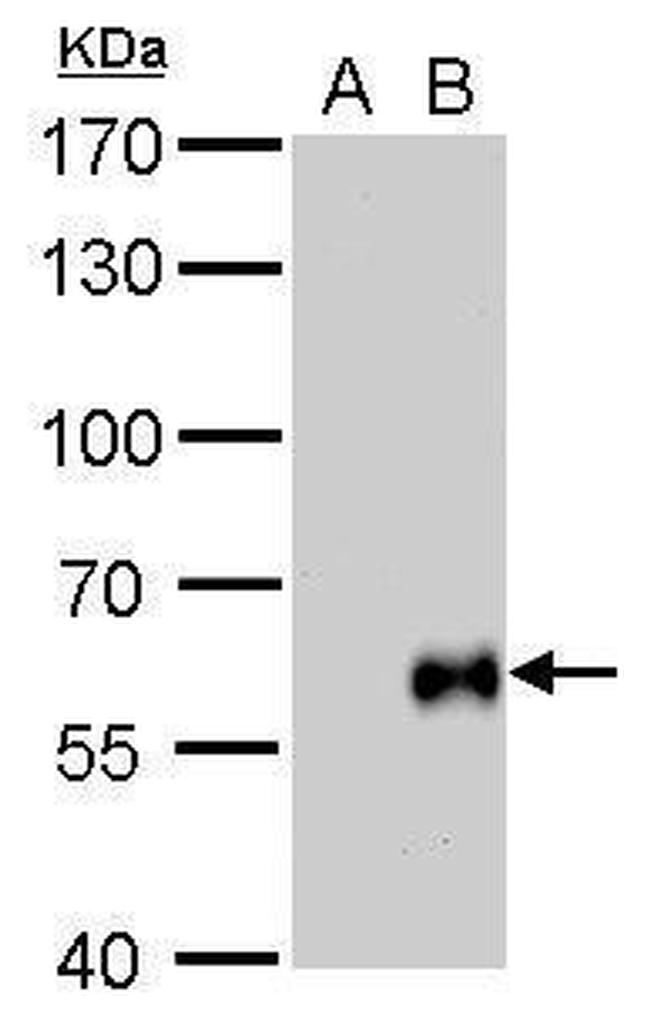 Influenza B HA Antibody in Western Blot (WB)