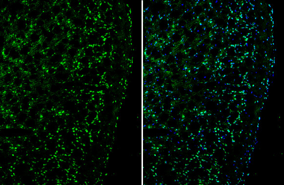 PLXND1 Antibody in Immunohistochemistry (Frozen) (IHC (F))