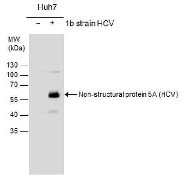 Hepatitis C Virus NS5A Antibody in Western Blot (WB)