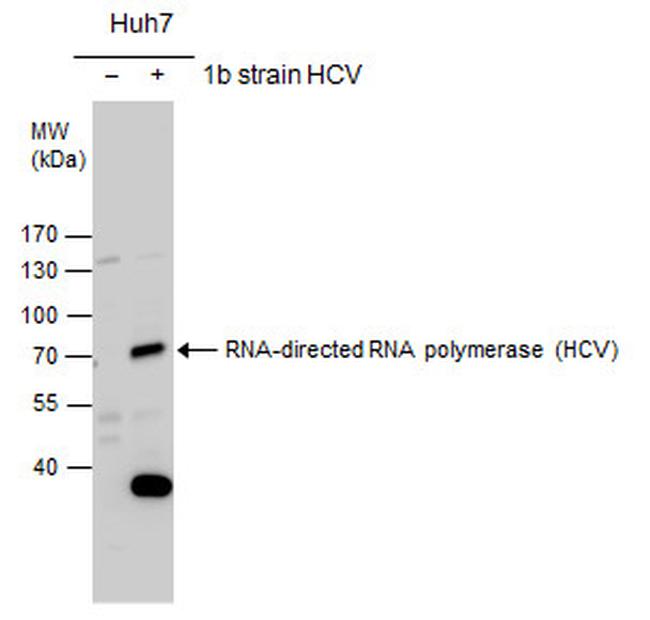 Hepatitis C Virus NS5b Antibody in Western Blot (WB)