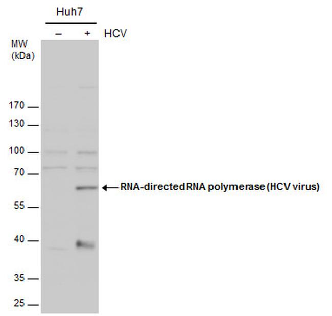 Hepatitis C Virus NS5b Antibody in Western Blot (WB)