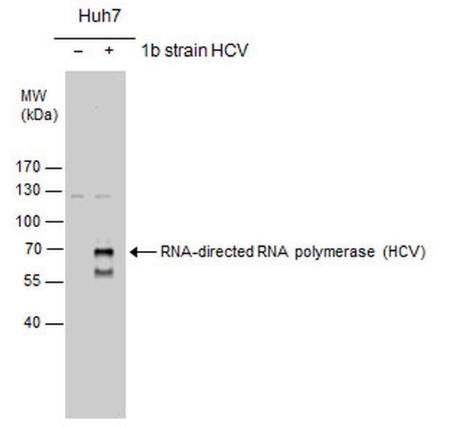 Hepatitis C Virus NS5b Antibody in Western Blot (WB)