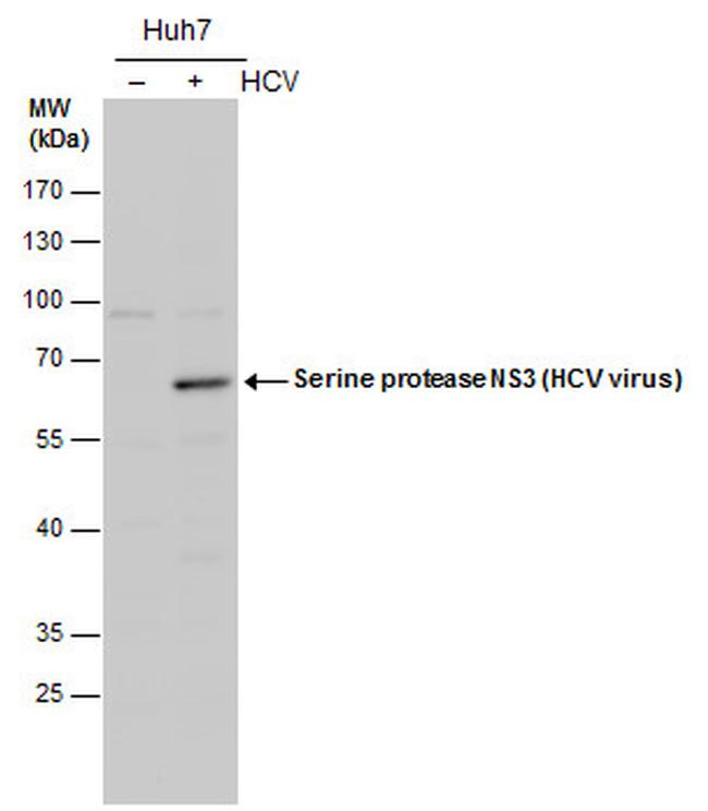 Hepatitis C Virus NS3 Antibody in Western Blot (WB)