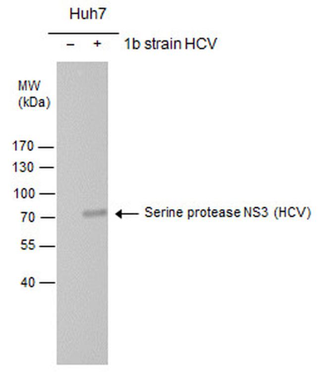 Hepatitis C Virus NS3 Antibody in Western Blot (WB)