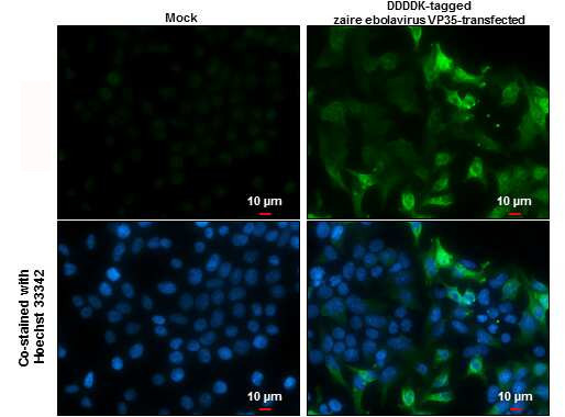 Ebola Virus VP35 Antibody in Immunocytochemistry (ICC/IF)