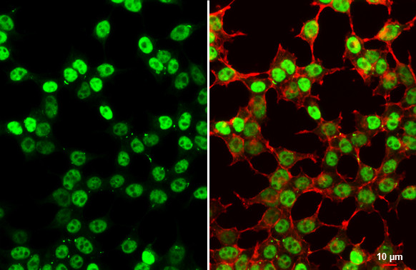 SV40 T-Antigen Antibody in Immunocytochemistry (ICC/IF)