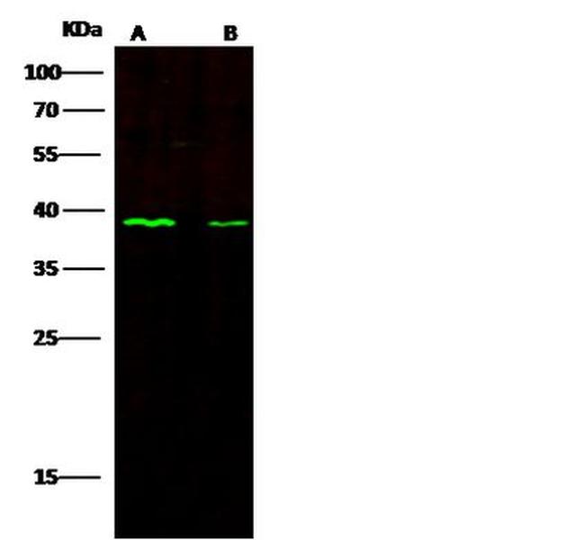 CD1c Antibody in Western Blot (WB)