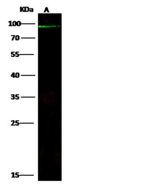 ABCB5 Antibody in Western Blot (WB)