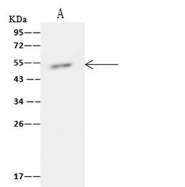 TIPIN Antibody in Immunoprecipitation (IP)