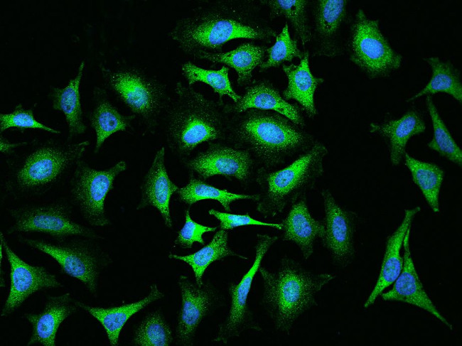 ABCF2 Antibody in Immunocytochemistry (ICC/IF)