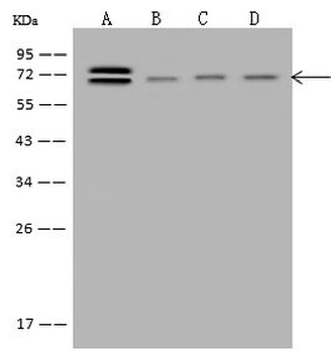 ABCF2 Antibody in Western Blot (WB)