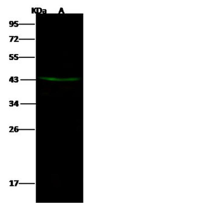 DACH2 Antibody in Western Blot (WB)