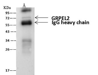 B3GNT3 Antibody in Immunoprecipitation (IP)