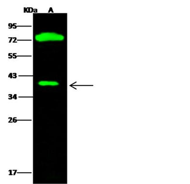 CTBS Antibody in Western Blot (WB)