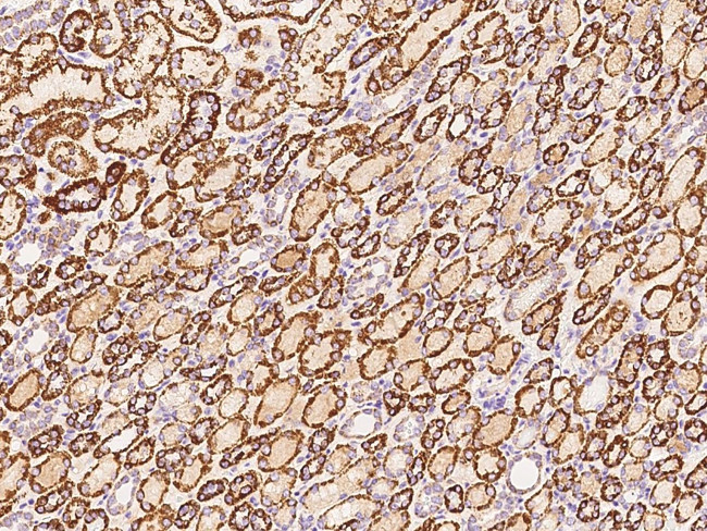 ATP Synthase beta Antibody in Immunohistochemistry (Paraffin) (IHC (P))