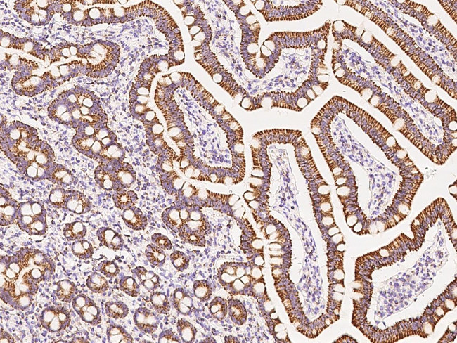 ATP Synthase beta Antibody in Immunohistochemistry (Paraffin) (IHC (P))