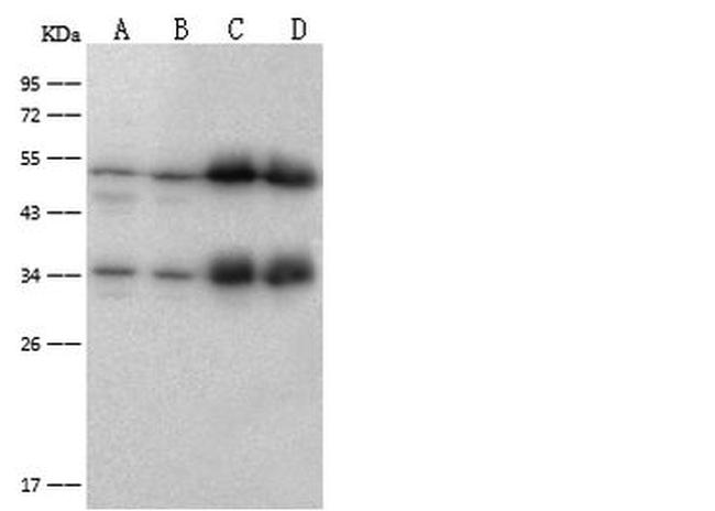 ATP Synthase beta Antibody in Western Blot (WB)