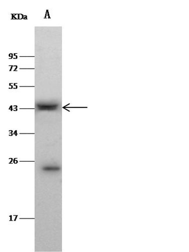 CLEC9A Antibody in Western Blot (WB)