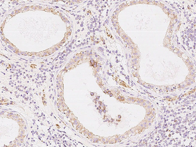 COX17 Antibody in Immunohistochemistry (Paraffin) (IHC (P))