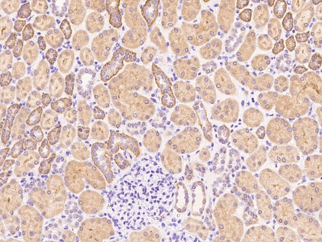 P2Y6 Antibody in Immunohistochemistry (Paraffin) (IHC (P))