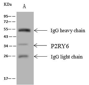 P2Y6 Antibody in Immunoprecipitation (IP)