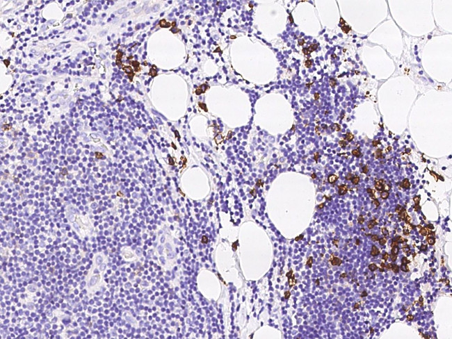 CD38 Antibody in Immunohistochemistry (Paraffin) (IHC (P))