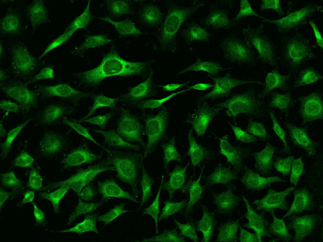 CRP Antibody in Immunocytochemistry (ICC/IF)