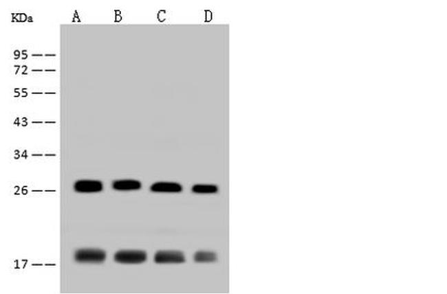 CRP Antibody in Western Blot (WB)