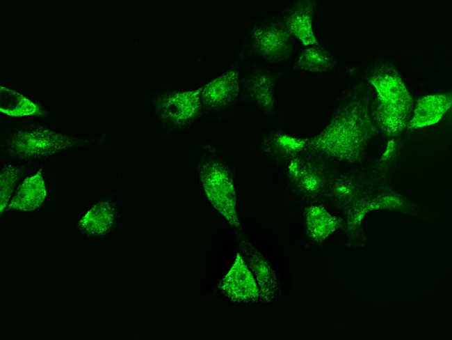 Galectin 7 Antibody in Immunocytochemistry (ICC/IF)