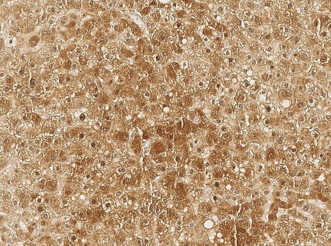 Galectin 7 Antibody in Immunohistochemistry (Paraffin) (IHC (P))