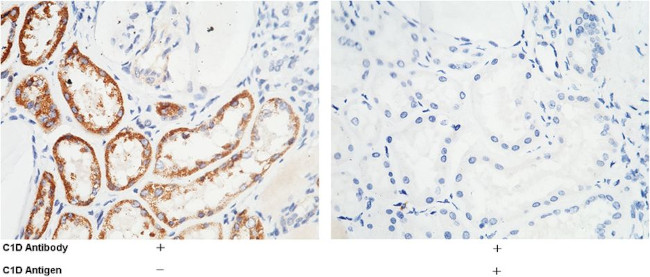 C1D Antibody in Immunohistochemistry (Paraffin) (IHC (P))