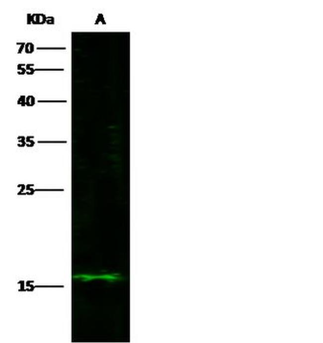 C1D Antibody in Western Blot (WB)