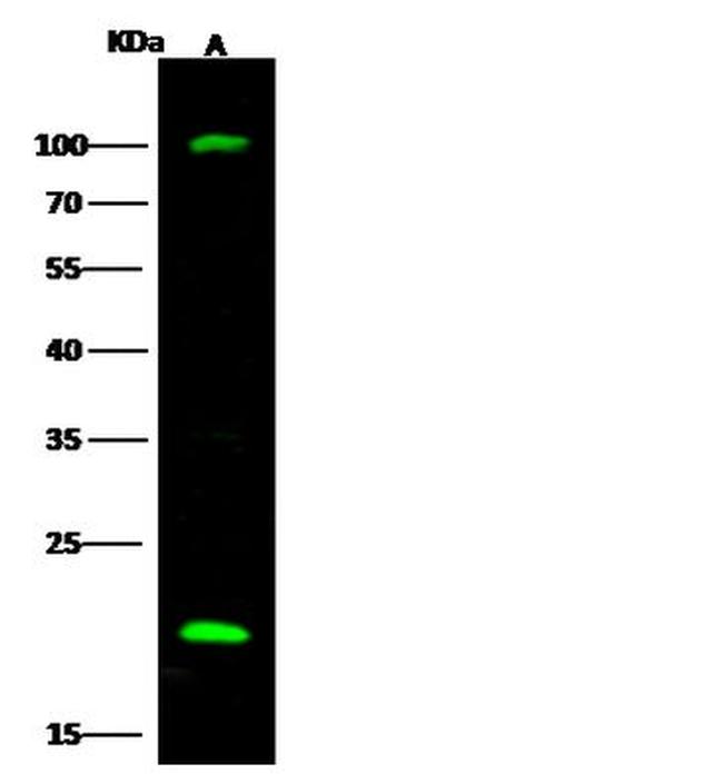 UBE2H Antibody in Western Blot (WB)