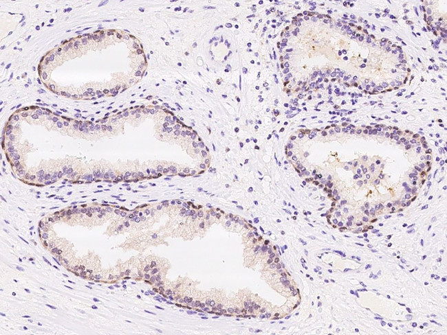 PSPH Antibody in Immunohistochemistry (Paraffin) (IHC (P))