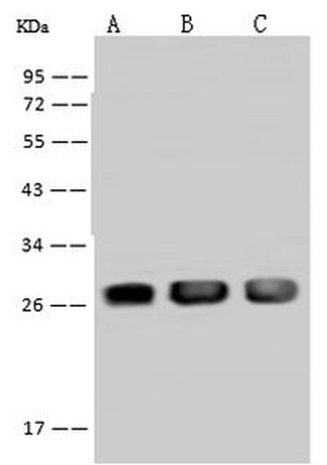 PSPH Antibody in Western Blot (WB)