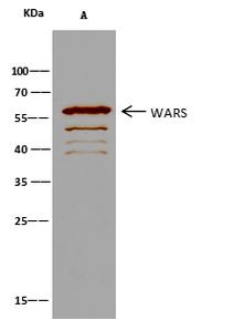 WARS Antibody in Immunoprecipitation (IP)