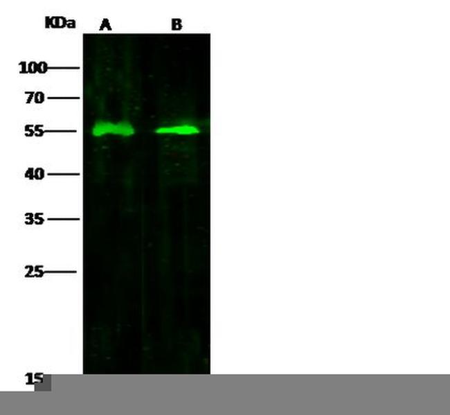 WARS Antibody in Western Blot (WB)