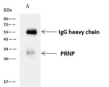 PrP Antibody in Immunoprecipitation (IP)