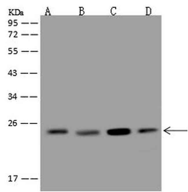 MAD2 Antibody in Western Blot (WB)