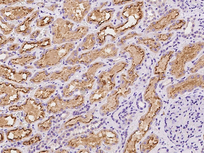 KBP Antibody in Immunohistochemistry (Paraffin) (IHC (P))