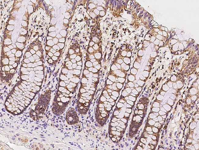 ICT1 Antibody in Immunohistochemistry (Paraffin) (IHC (P))