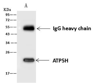 ATP5H Antibody in Immunoprecipitation (IP)