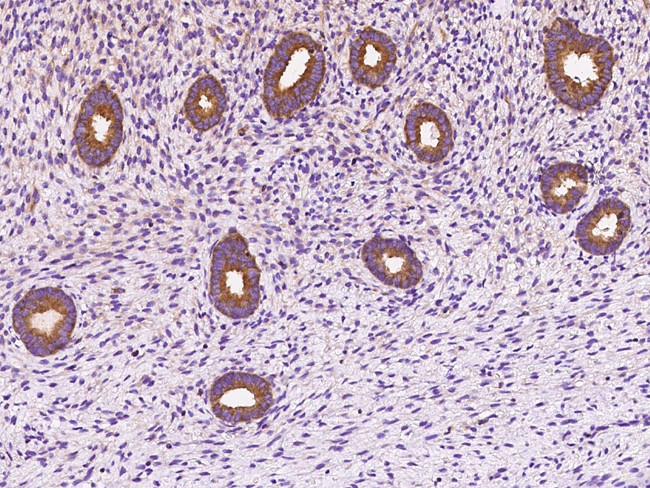 DYNC1LI1 Antibody in Immunohistochemistry (Paraffin) (IHC (P))