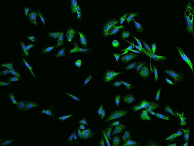 RAB5IF Antibody in Immunocytochemistry (ICC/IF)